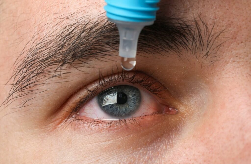 Close up of a man with dry eyes using eye drops.